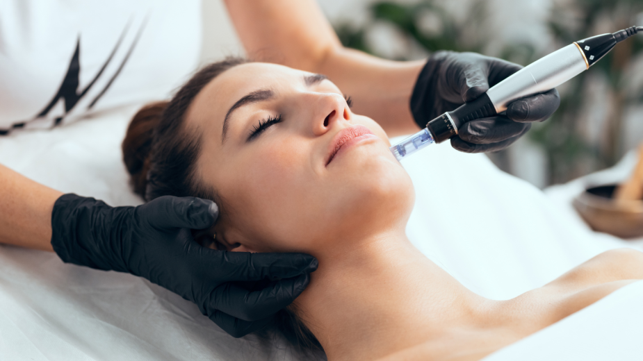 Microneedling-1